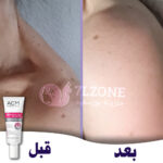 depiwhite-advanced-cream