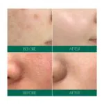 تونر-ميركل-لعلاج-حب-الشباب-ومشاكل-البشرة-تحدي-ال30-يوم-SomeByMi-AHA-BHA-PHA-30-Days-Miracle-Toner-150ml-(5oz)-Anti-acne-Exfoliation-Hydration-Brightening