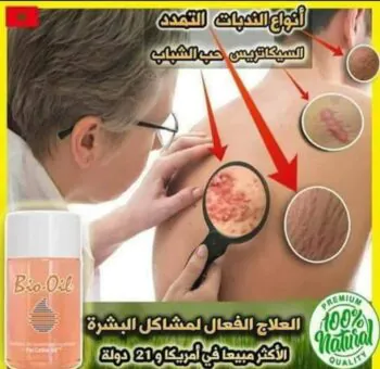 زيت بايو اويل الاصلي
