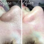 سكرب-بيكينج-باودر-من-ايتيود-هاوس-7-جرام–ETUDE-HOUSE-KOREAN-COSMETICS-BAKING-POWDER-CRUNCH-PORE-SCRUB