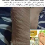 ماسك-تقشير-القدم-الكوري-من-بيور-ديرم–purederm-exfoliating-foot-mask-Peels-Away-Calluses-And-Dead-Skin-(23 (1)