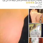 ماسك-تقشير-القدم-الكوري-من-بيور-ديرم–purederm-exfoliating-foot-mask-Peels-Away-Calluses-And-Dead-Skin-(23 (1)