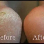 ماسك-تقشير-القدم-الكوري-من-بيور-ديرم–purederm-exfoliating-foot-mask-Peels-Away-Calluses-And-Dead-Skin-(23 (1)